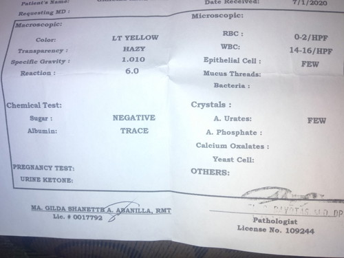 Urinalysis Result