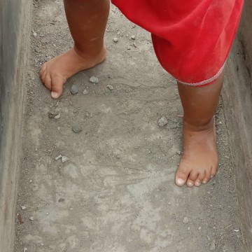 kaki bengkong