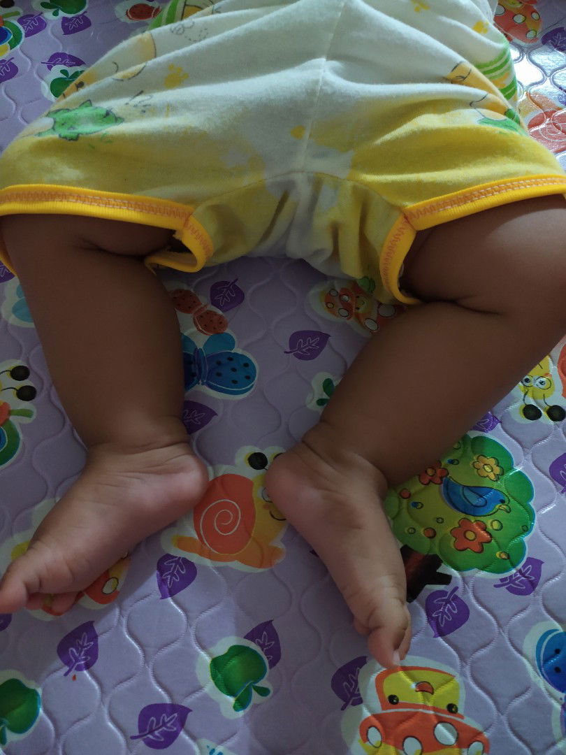 bentuk kaki bayi