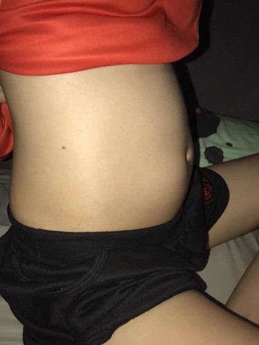 ตอนนี้18w5d เค้าบอกท้องเล็กมาก