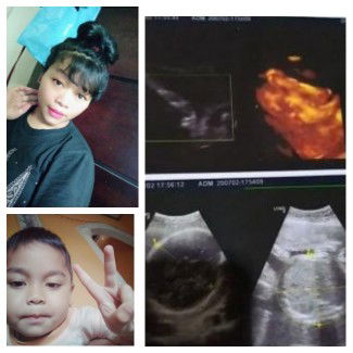 Lina Adriyana profile icon