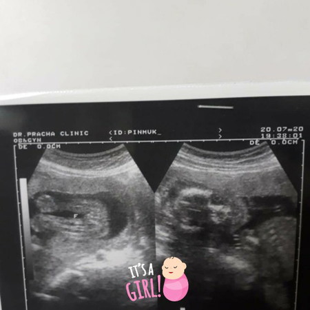 เห็นสักทีลูกสาว