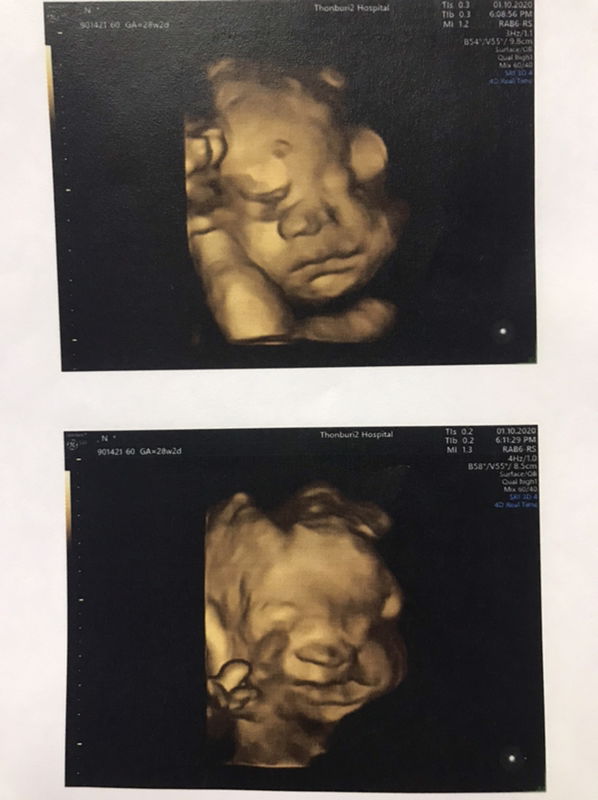 Fern Preeyaporn profile icon