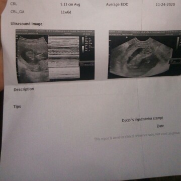 16 weeks preggy