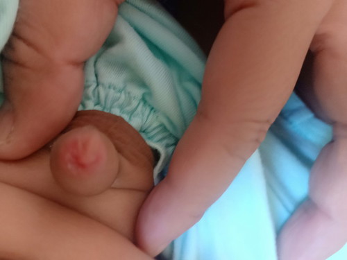 ปลายจู๋ลูกแดงค่ะ