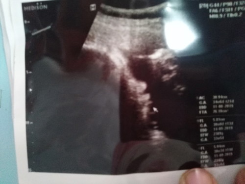 น้ำหนักตัวลูก