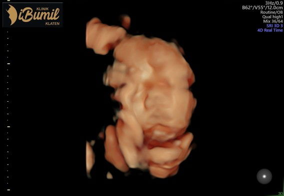 Dwiyanti Nur Alifah profile icon