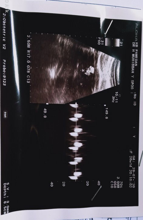 masih tentang hasil USG