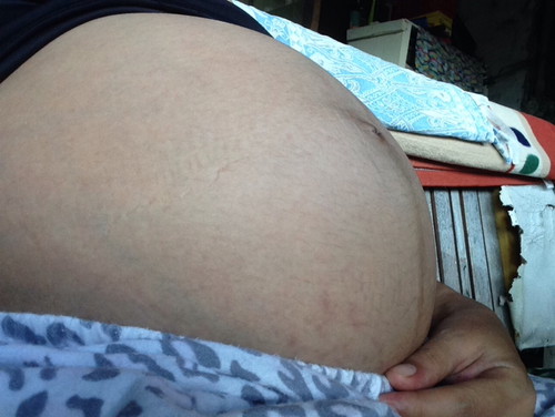 Size of the bump