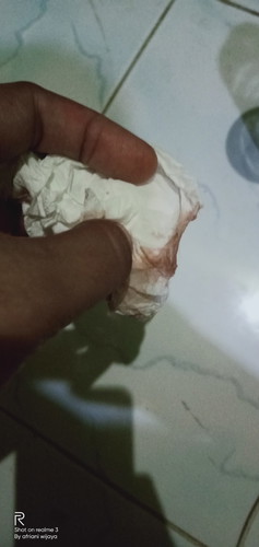 flek berwarna coklat