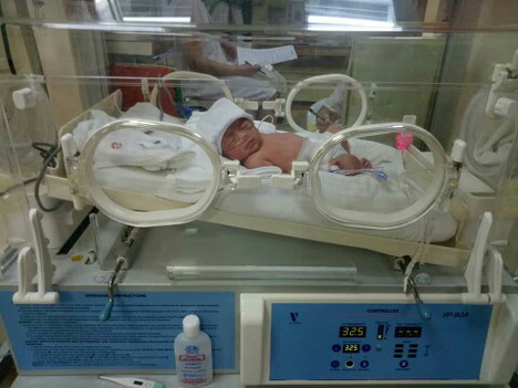 my premature baby...