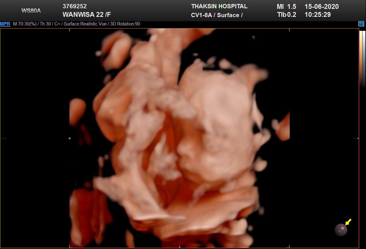 หลงรัก♥️