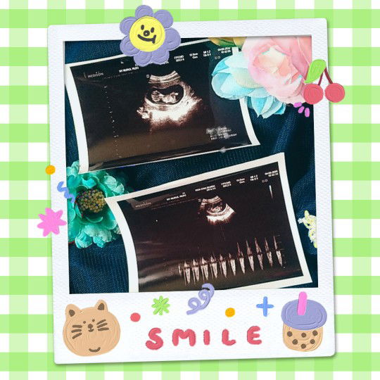 Nurul Rizki profile icon