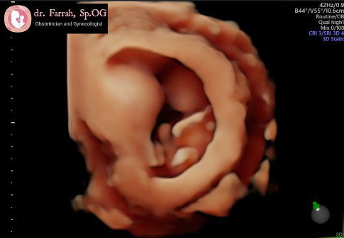 uci intan profile icon