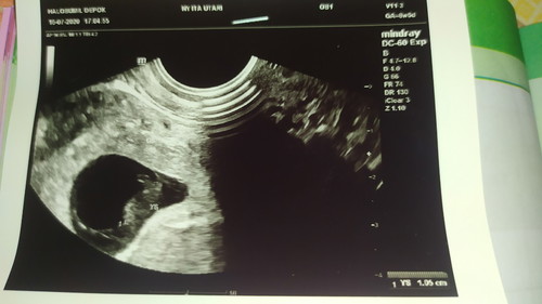 kehamilan pertamaku.β€οΈ