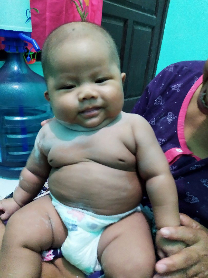 bayi gendut