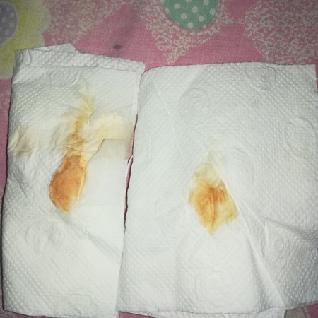 spotting at 6 weeks and 4 days