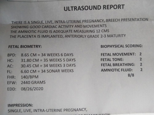 ultrasound
