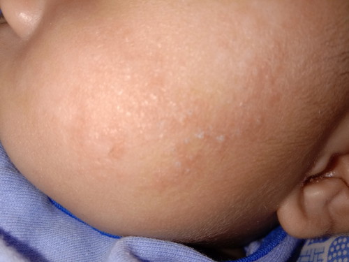 ขอสอบถาม