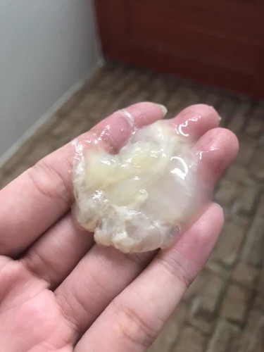 38+1 มีมูกออกมาครั้งแรกเมื่อคืนไม่เยอะมาวันนี้ออกมาเยอะมากแต่ไม่มีมูกเลือดปนมา