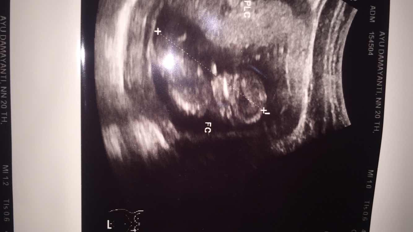 Ayu Damayanti profile icon