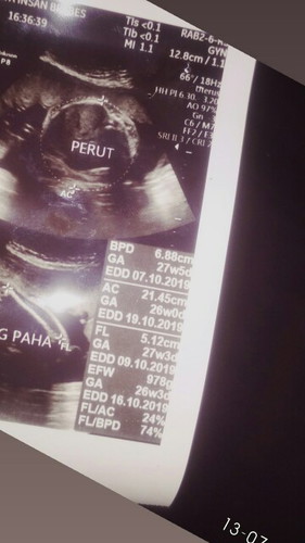 Usia Kandungan Yg Tepat