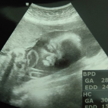 ลูกสาวของพ่อ