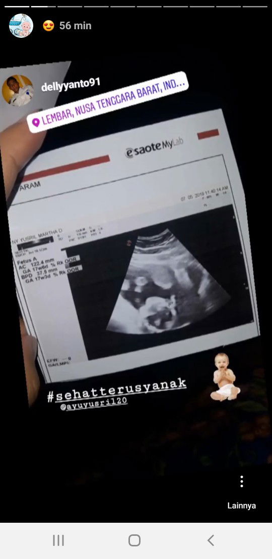 Dhelviyani Purnomo profile icon