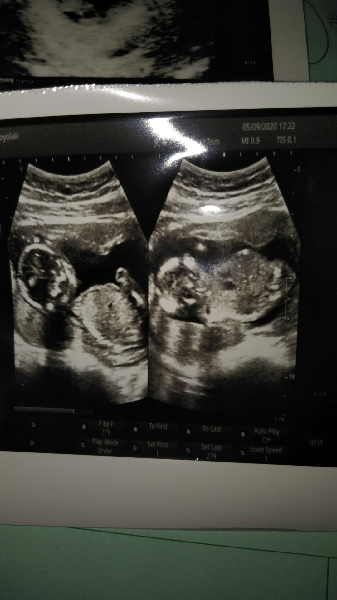 Rita Prasetyaningsih profile icon