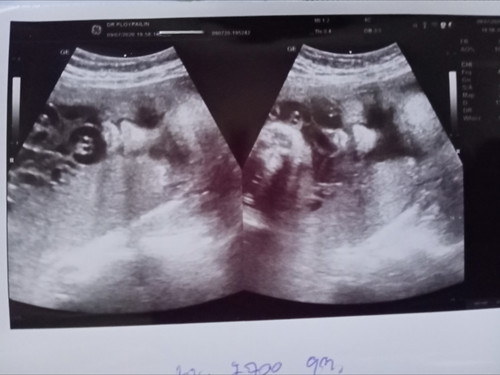 ทีม ก.ค น้ำหนักลูกเท่าไหร่กันแล้ว