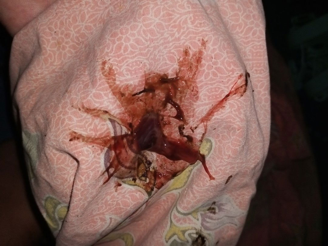 หมอกวาดปากมดลูกแล้วมีเลือดออก