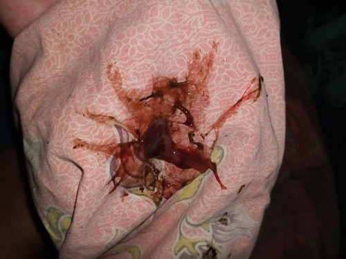 หมอกวาดปากมดลูกแล้วมีเลือดออก