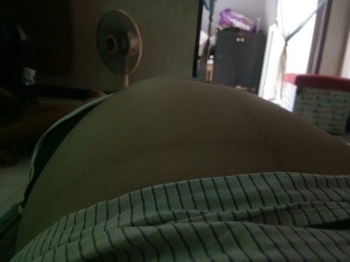 ท้องแข็ง