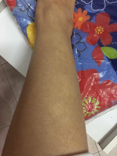 เป็นด่างๆขาวๆ