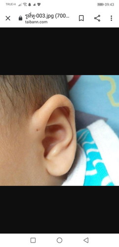 รูใกล้หู