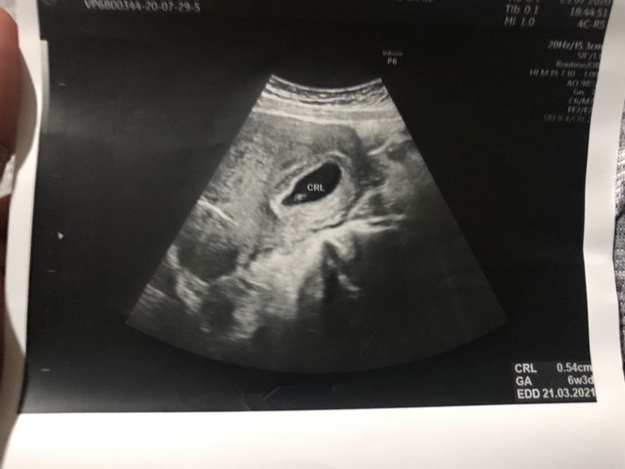 สอบถามผู้รู้และแม่ๆที่มีประสบการณ์หน่อยค่ะ