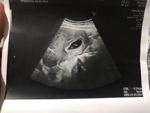 สอบถามผู้รู้และแม่ๆที่มีประสบการณ์หน่อยค่ะ