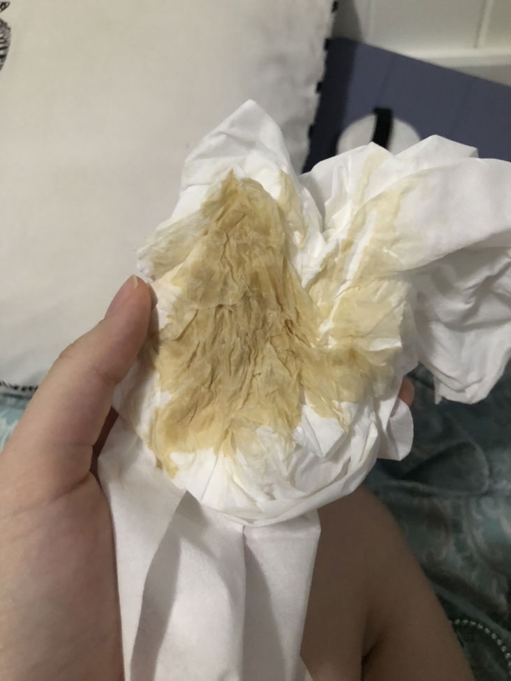 แบบนี้ต้องไปหาหมอไหมคะ