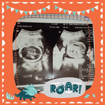 alfiatus sholihah profile icon