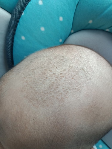 ลูกบ้านไหนเป็นบ้างคะ