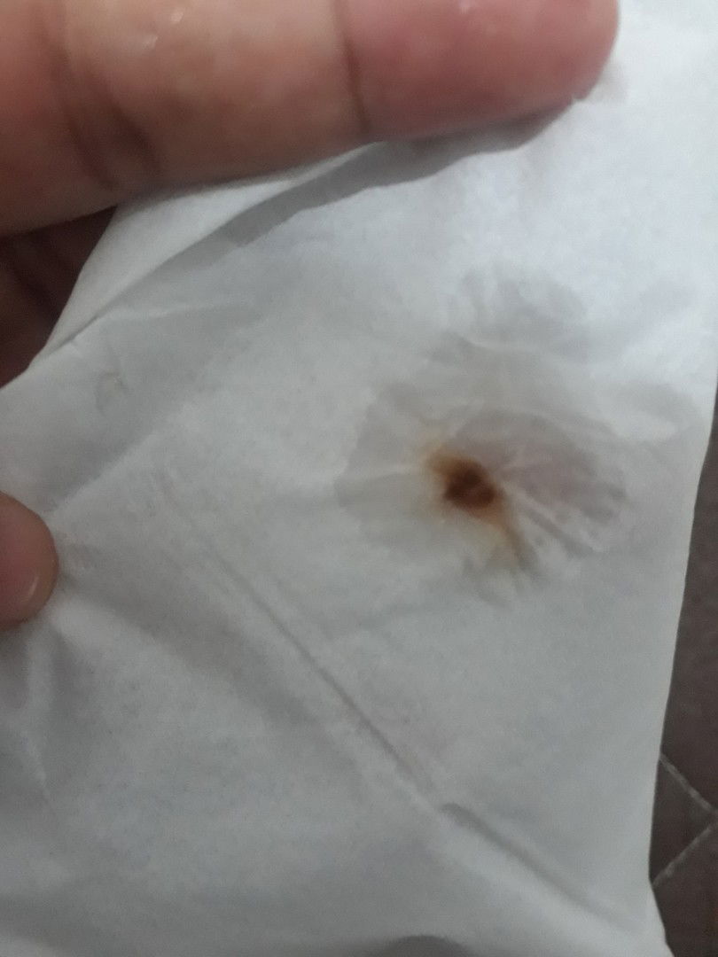 kluar lendir bercak darah