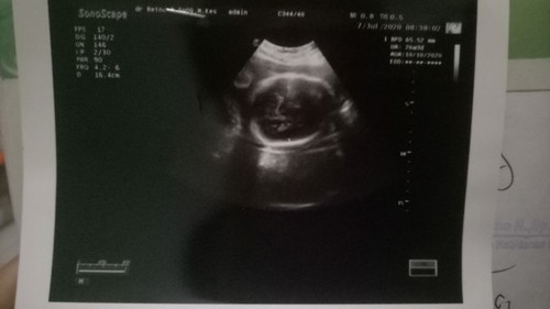 kandungan 26 weeks