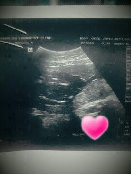 Odette Ann Dantes profile icon