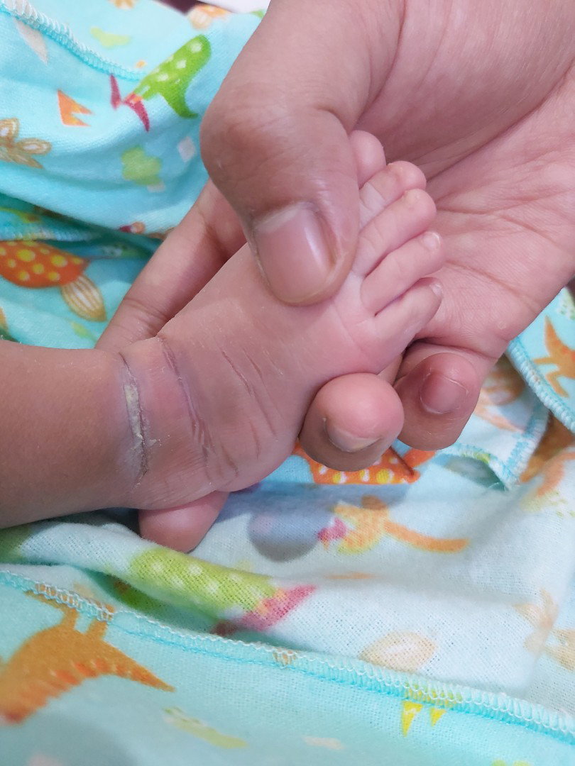 kaki bayi baru lahir