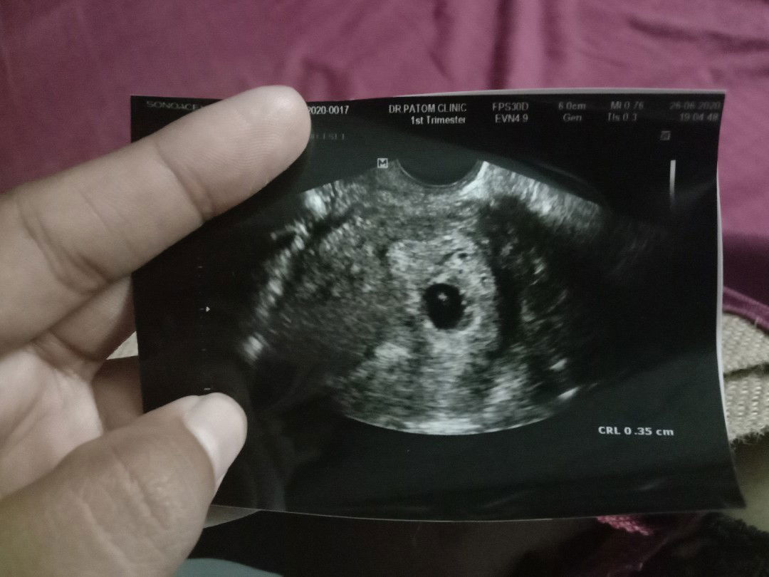 รู้สึกกังวลใจ