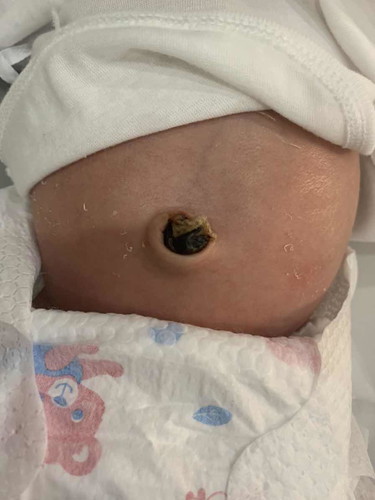 Pusod ni baby at 8 days.