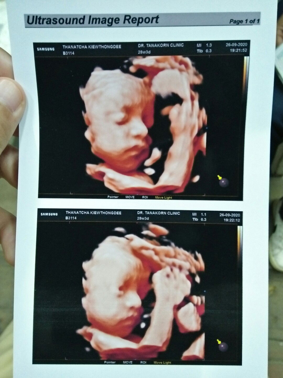 7 เดือนแล้วค่าา ขอดูใบซาวบ้านอื่นหน่อยค่ะ