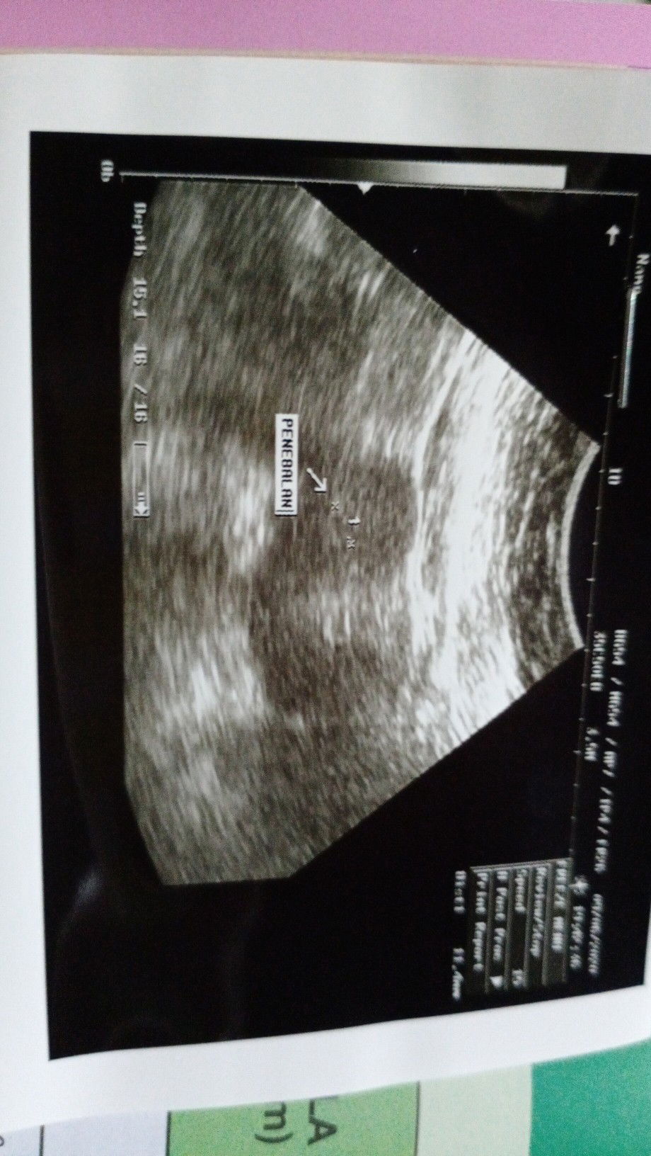 waktu baru telat 5 hari aq tespek