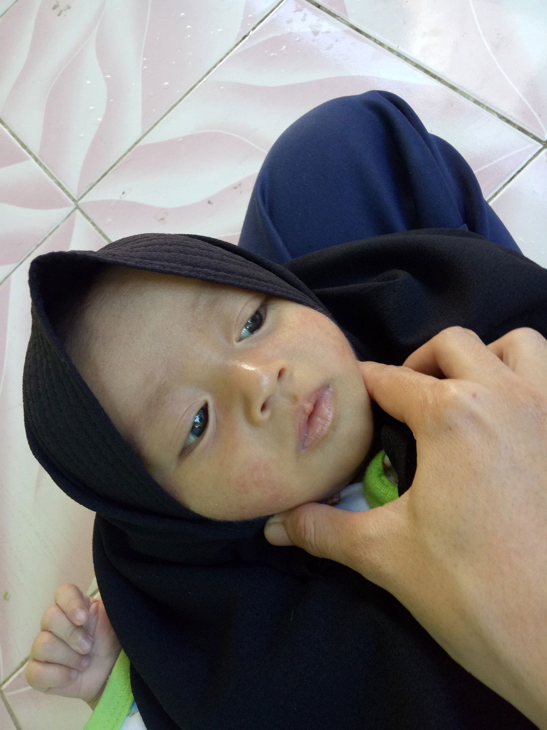 katanya si ruam susu