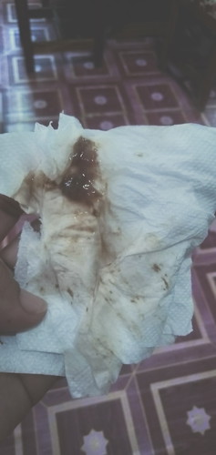 punta naba ako sa hospital?